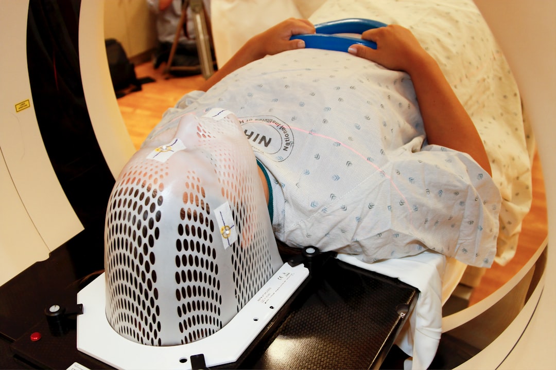 Connor Christou used AI to interpret PET scans and avoid unnecessary radiotherapy